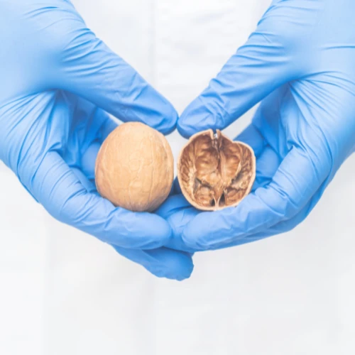 Imagen de: FSH, LH, TESTOSTERONA, PROLACTINA