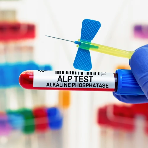 Imagen de: FOSFATASA ALCALINA