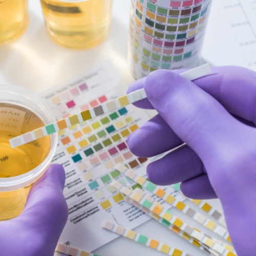 Imagen de: EXAMEN GENERAL DE ORINA