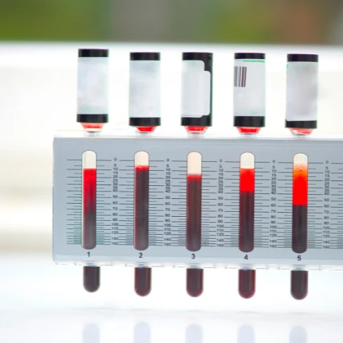 Imagen de: Sedimentación globular