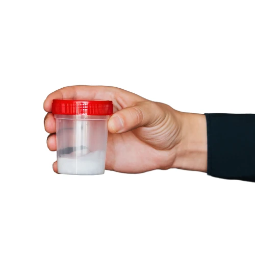 Imagen de: ESPERMATOBIOSCOPÍA