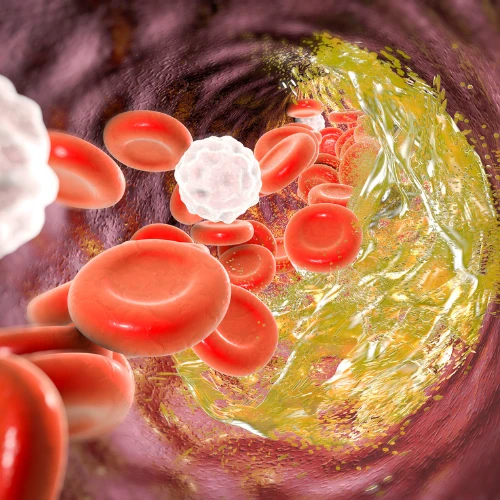 Imagen de: COLESTEROL ALTA/BAJA DENSIDAD