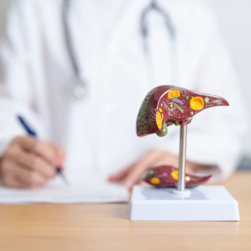 Imagen de: HEPATITIS VIRAL (VIRUS A+B+C+D)