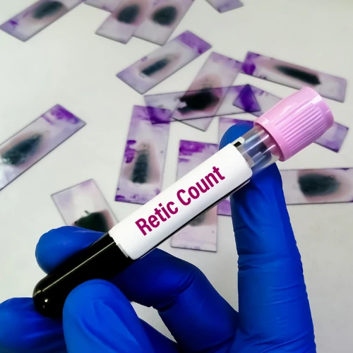 Imagen de: Reticulocitos